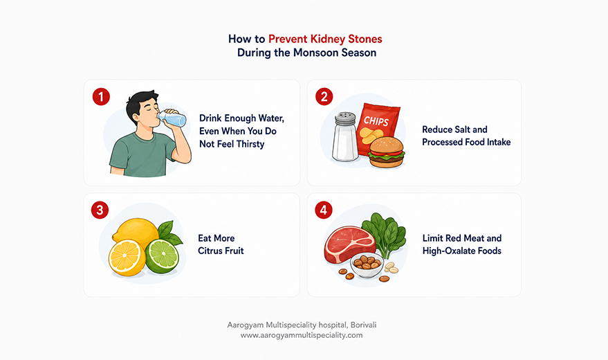 Infographic showing four simple ways to prevent kidney stones during the monsoon, including staying hydrated, reducing salt intake, eating citrus fruits, and limiting red meat and high-oxalate foods.